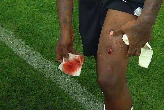 Lance normal, segue o jogo...