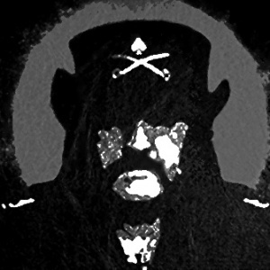Lemmy